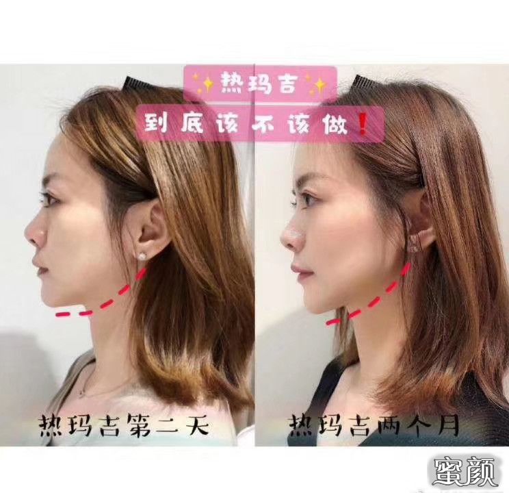 案例图片