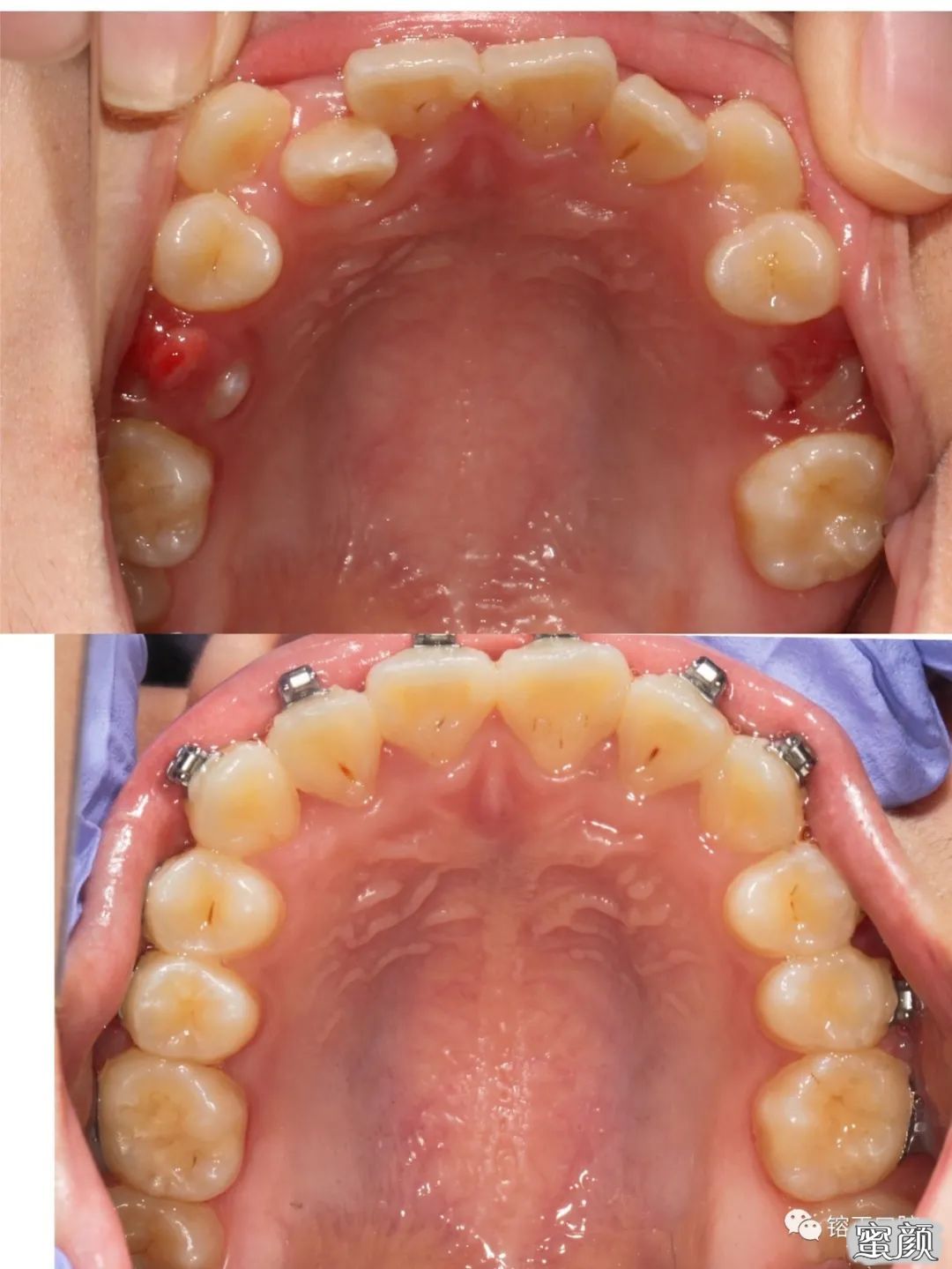 https://img.yiyiaimei.com/mnt/timg/200808/12255342Q-1.jpg