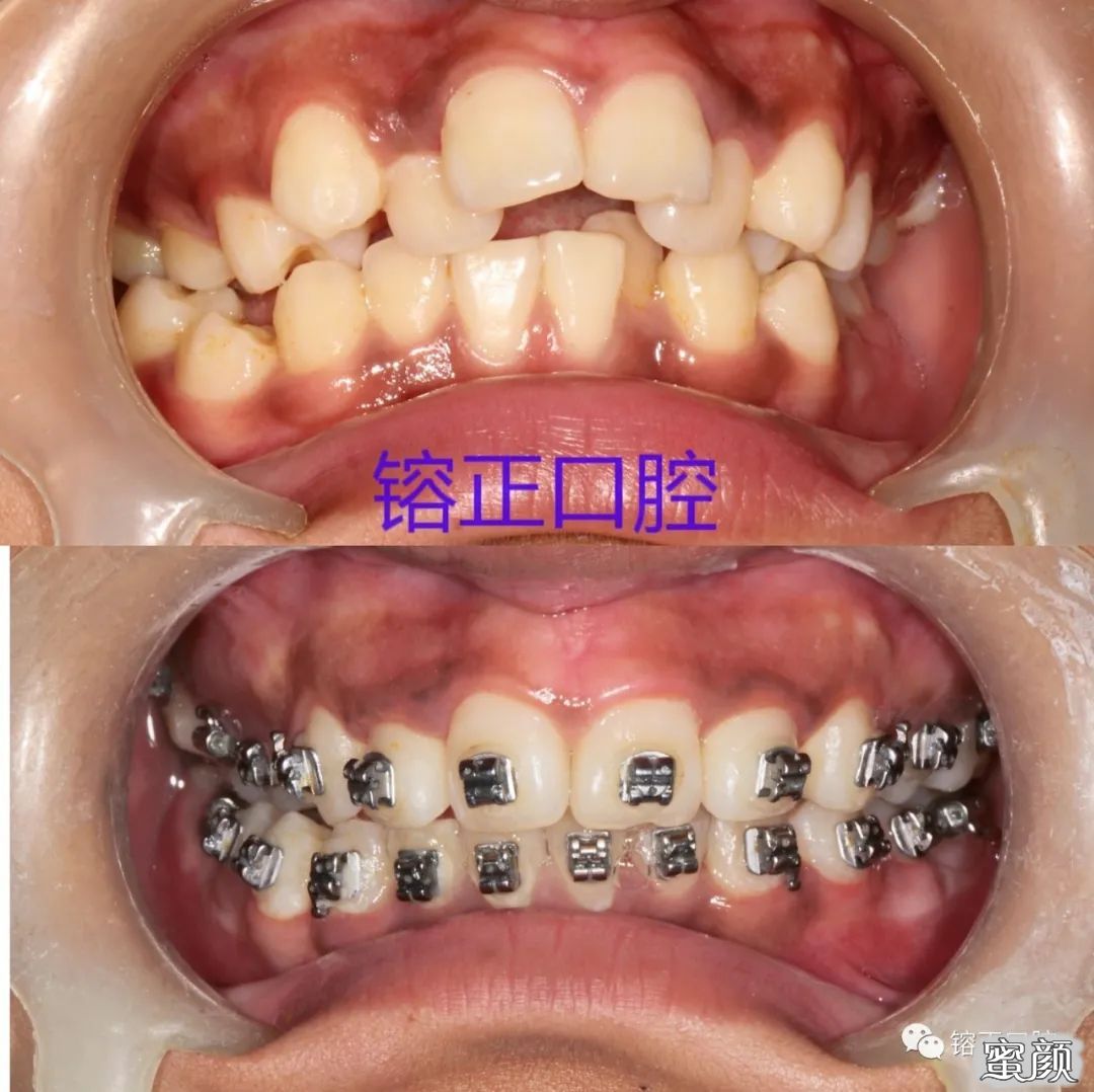https://img.yiyiaimei.com/mnt/timg/200808/1225562649-3.jpg