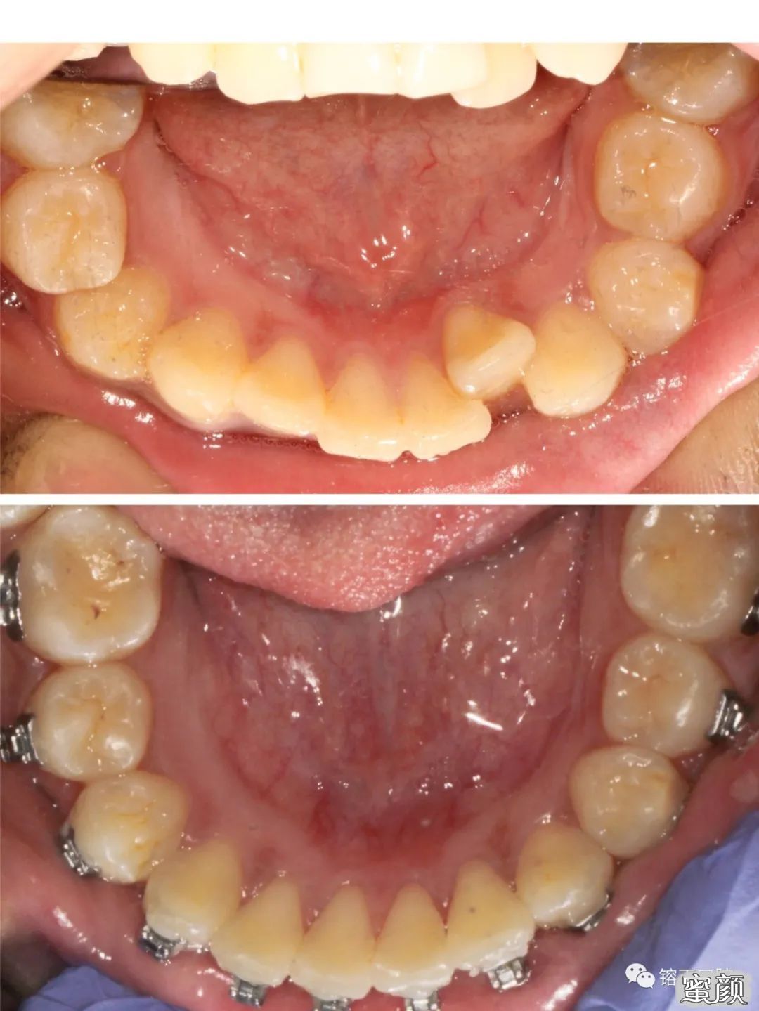 https://img.yiyiaimei.com/mnt/timg/200808/12255934T-5.jpg