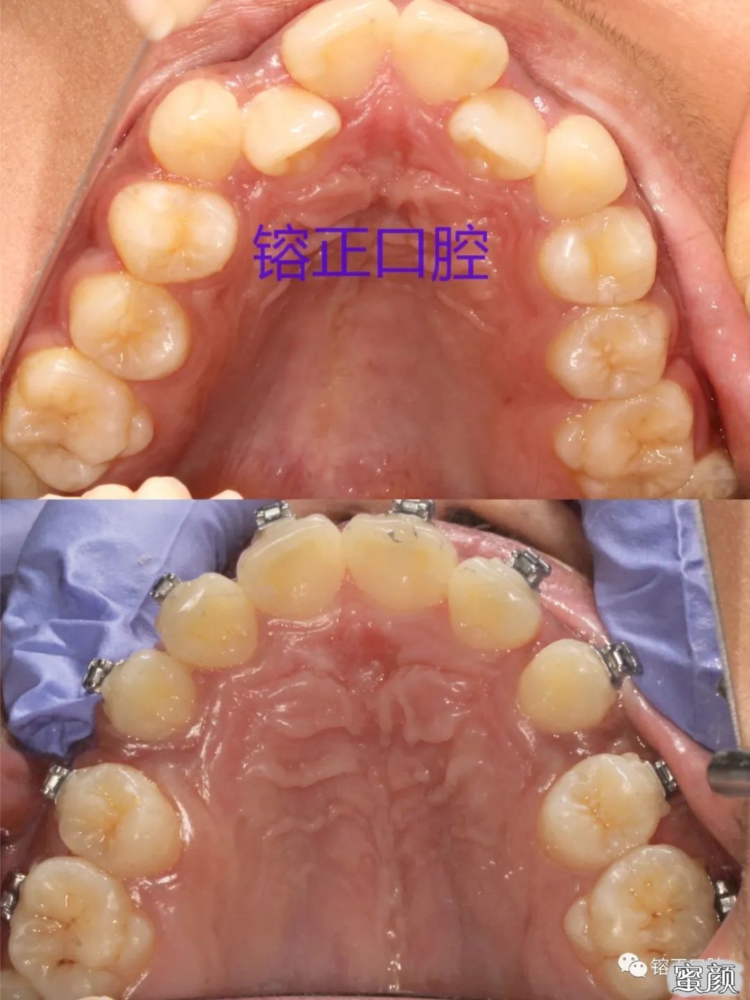 https://img.yiyiaimei.com/mnt/timg/200808/12255S1D-4.jpg