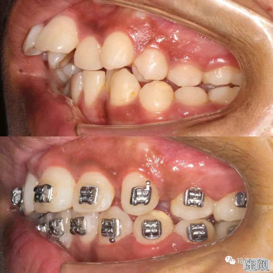https://img.yiyiaimei.com/mnt/timg/200808/1226004037-6.jpg