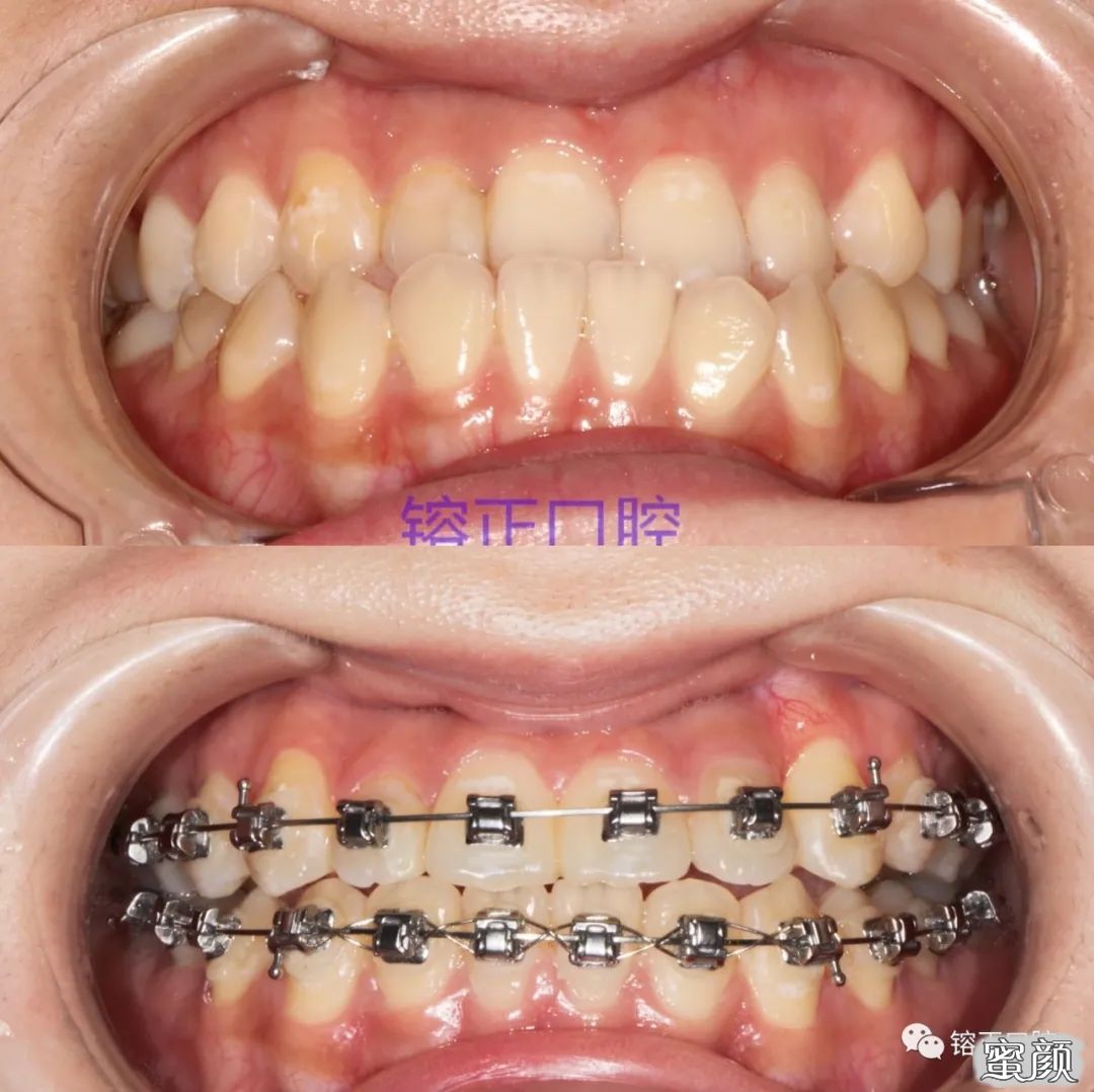 https://img.yiyiaimei.com/mnt/timg/200808/1226024C3-7.jpg