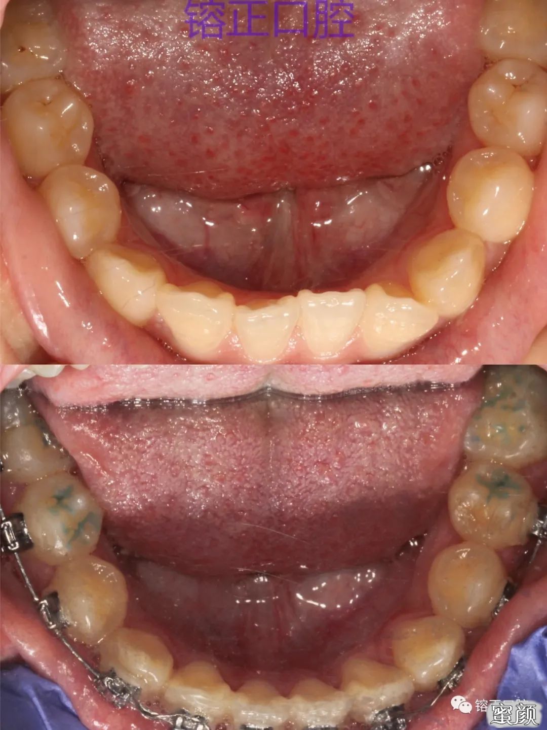 https://img.yiyiaimei.com/mnt/timg/200808/122605NA-9.jpg