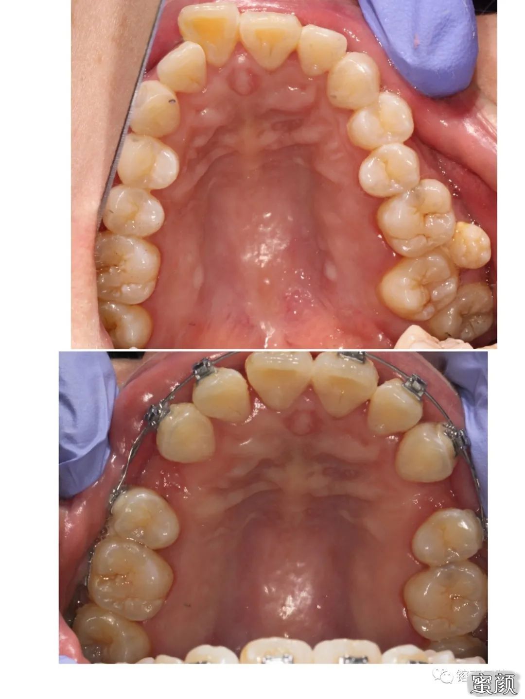 https://img.yiyiaimei.com/mnt/timg/200808/1226092053-13.jpg