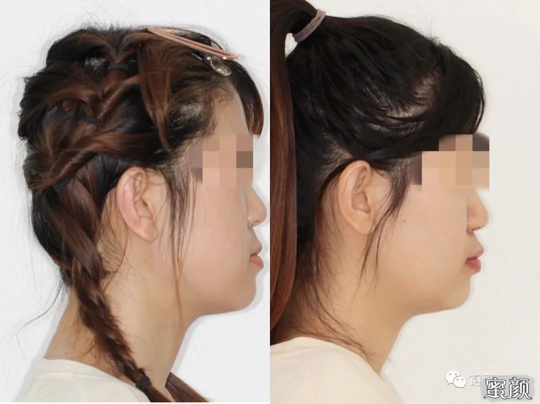 https://img.yiyiaimei.com/mnt/timg/200808/12260C0V-11.jpg
