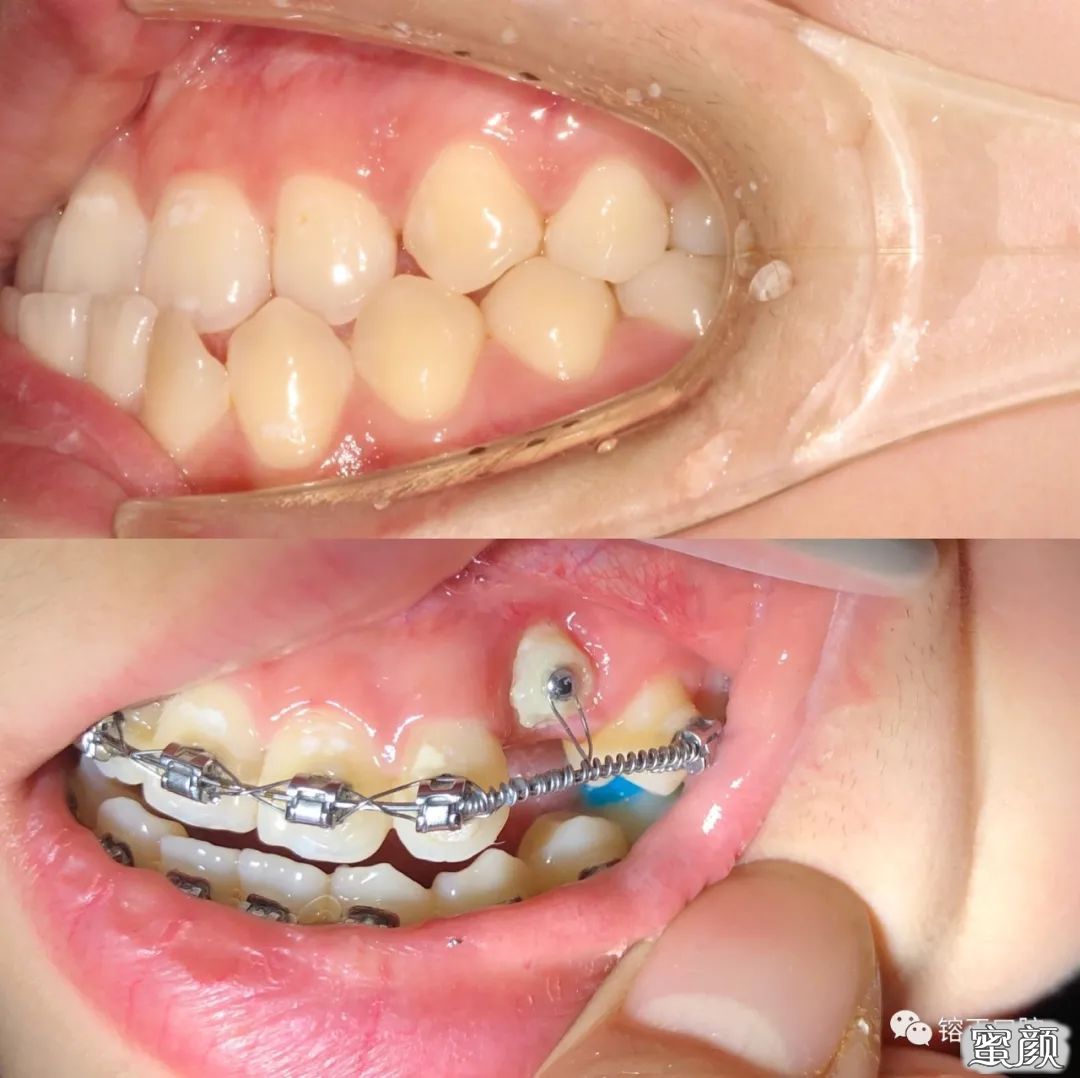 https://img.yiyiaimei.com/mnt/timg/200808/12260C243-10.jpg