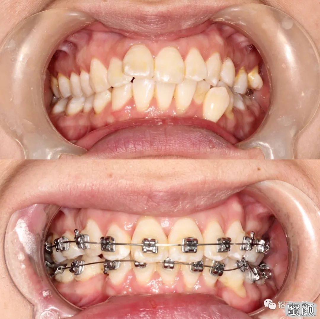 https://img.yiyiaimei.com/mnt/timg/200808/12260V433-12.jpg