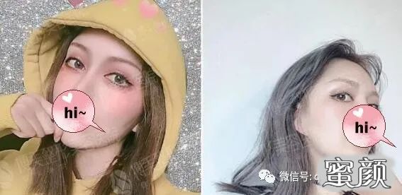 案例图片