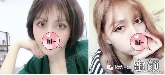 案例图片