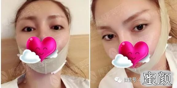 案例图片