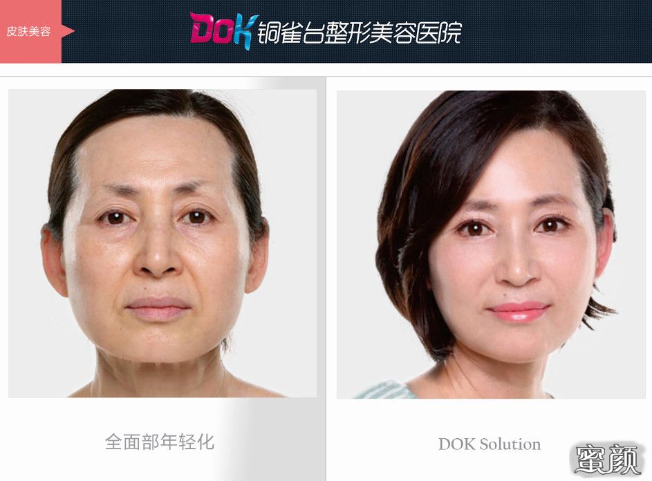 案例图片