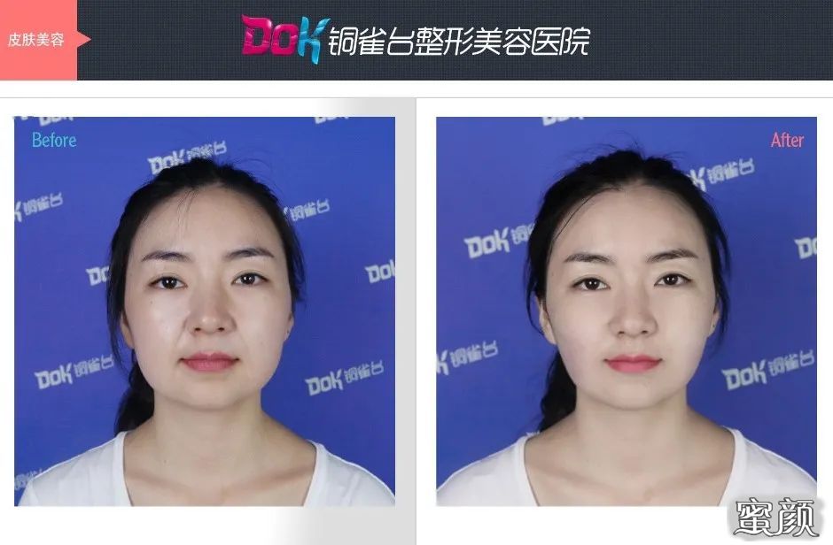 案例图片