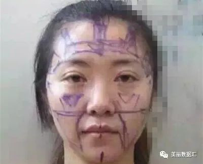 https://img.yiyiaimei.com/mnt/timg/200810/1243313350-1.jpg 案例图片
