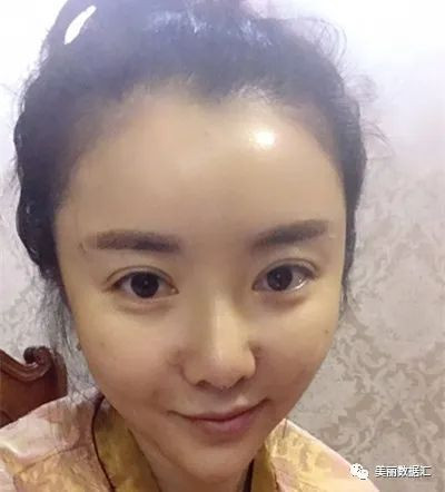 https://img.yiyiaimei.com/mnt/timg/200810/1243322058-2.jpg 案例图片