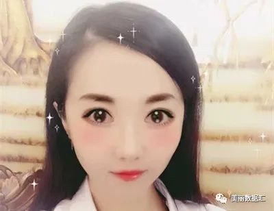 https://img.yiyiaimei.com/mnt/timg/200810/12433242D-5.jpg 案例图片