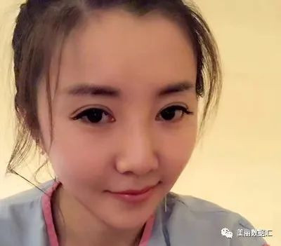 https://img.yiyiaimei.com/mnt/timg/200810/1243324945-4.jpg 案例图片