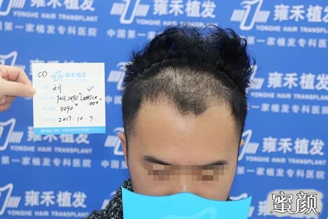 案例图片