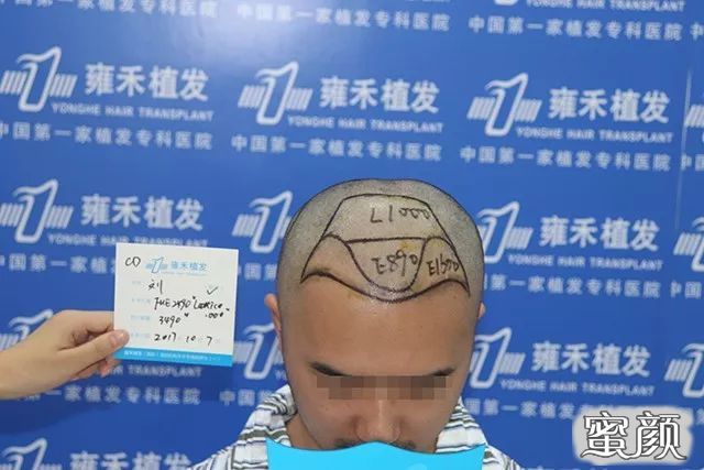 案例图片