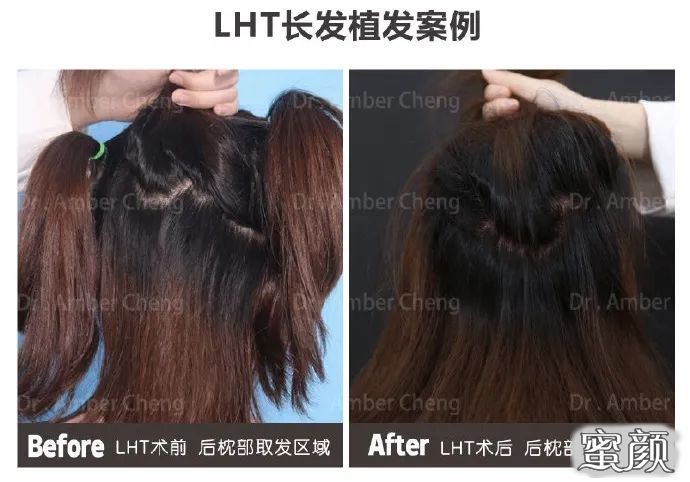 https://img.yiyiaimei.com/mnt/timg/200811/1051502136-1.jpg 案例图片
