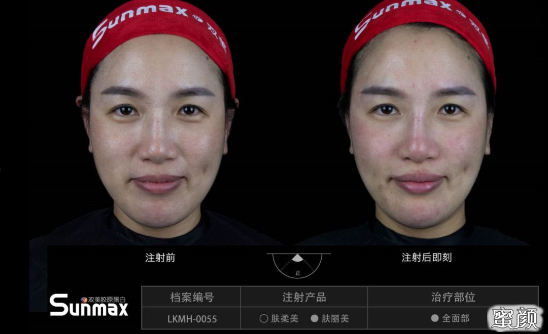 案例图片