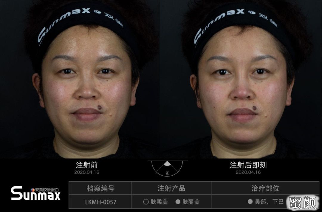 案例图片