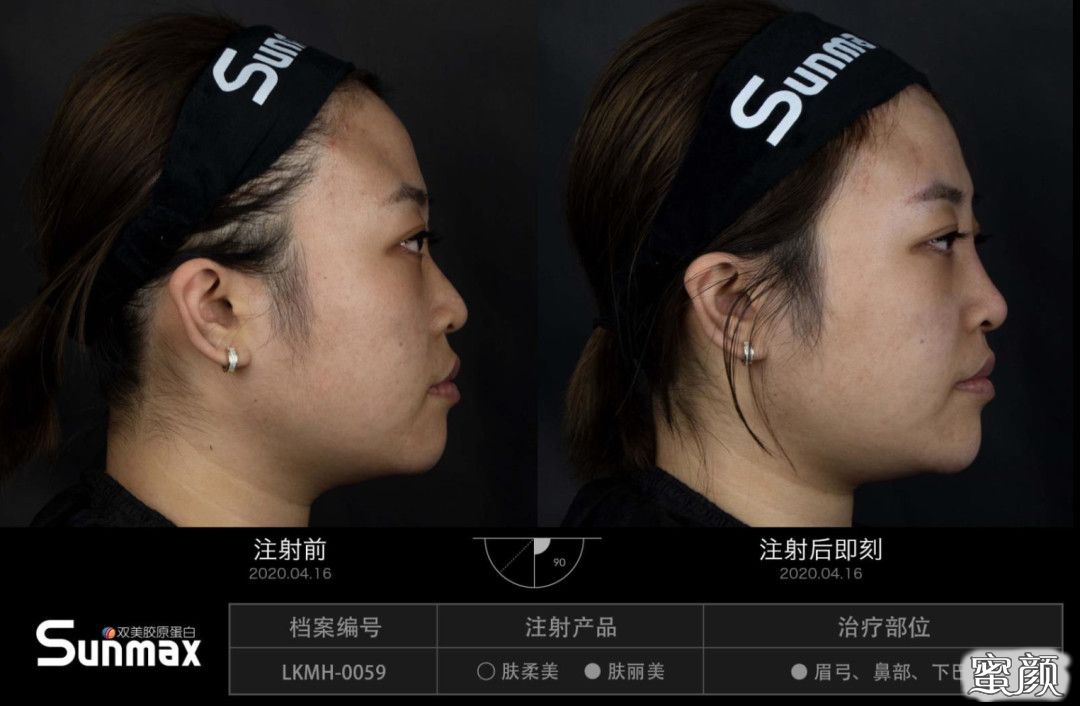 案例图片