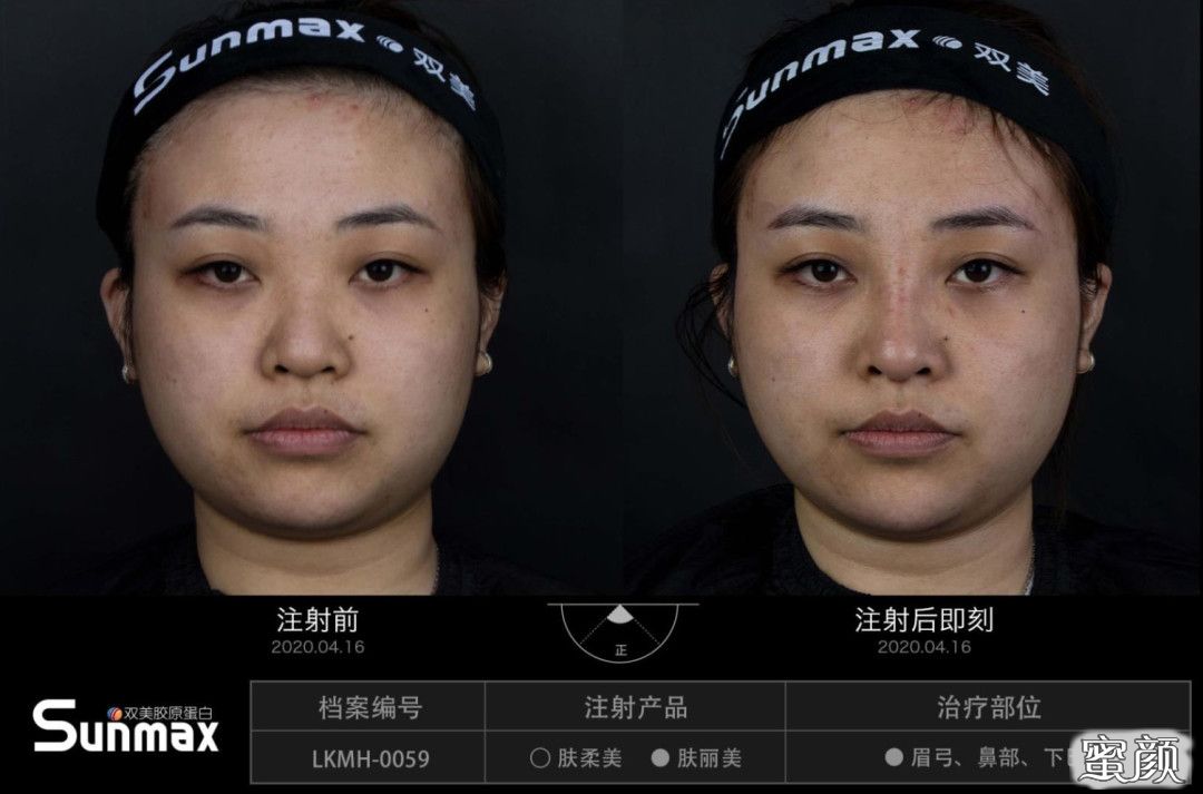 案例图片