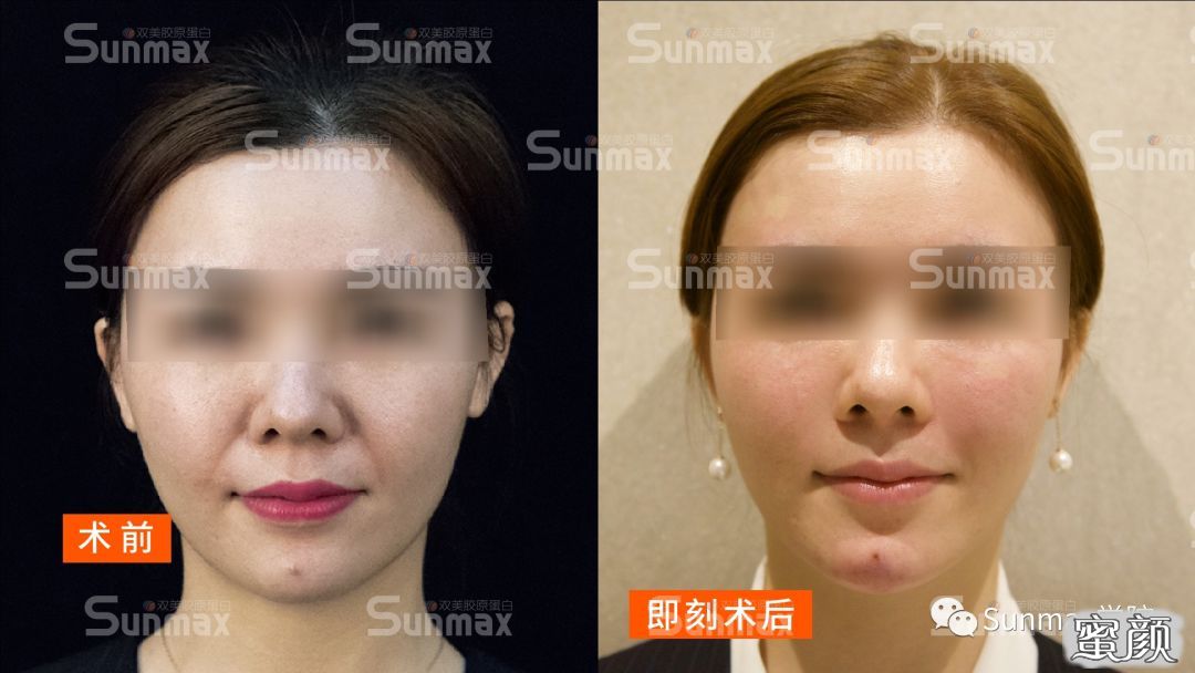 案例图片