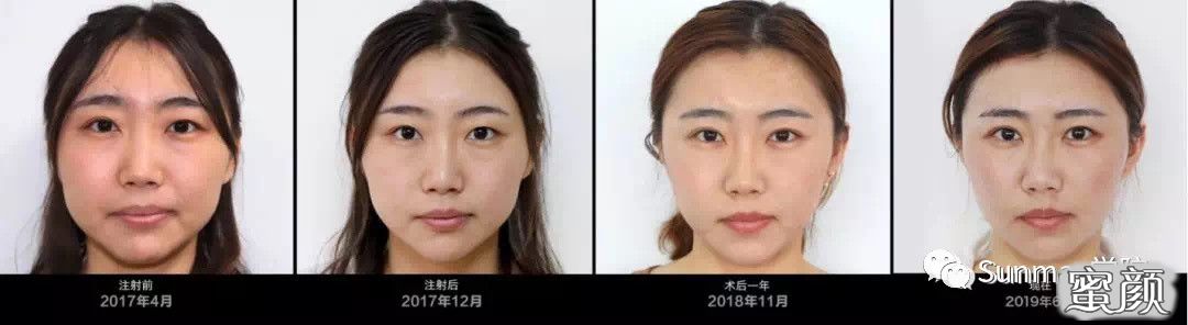 案例图片