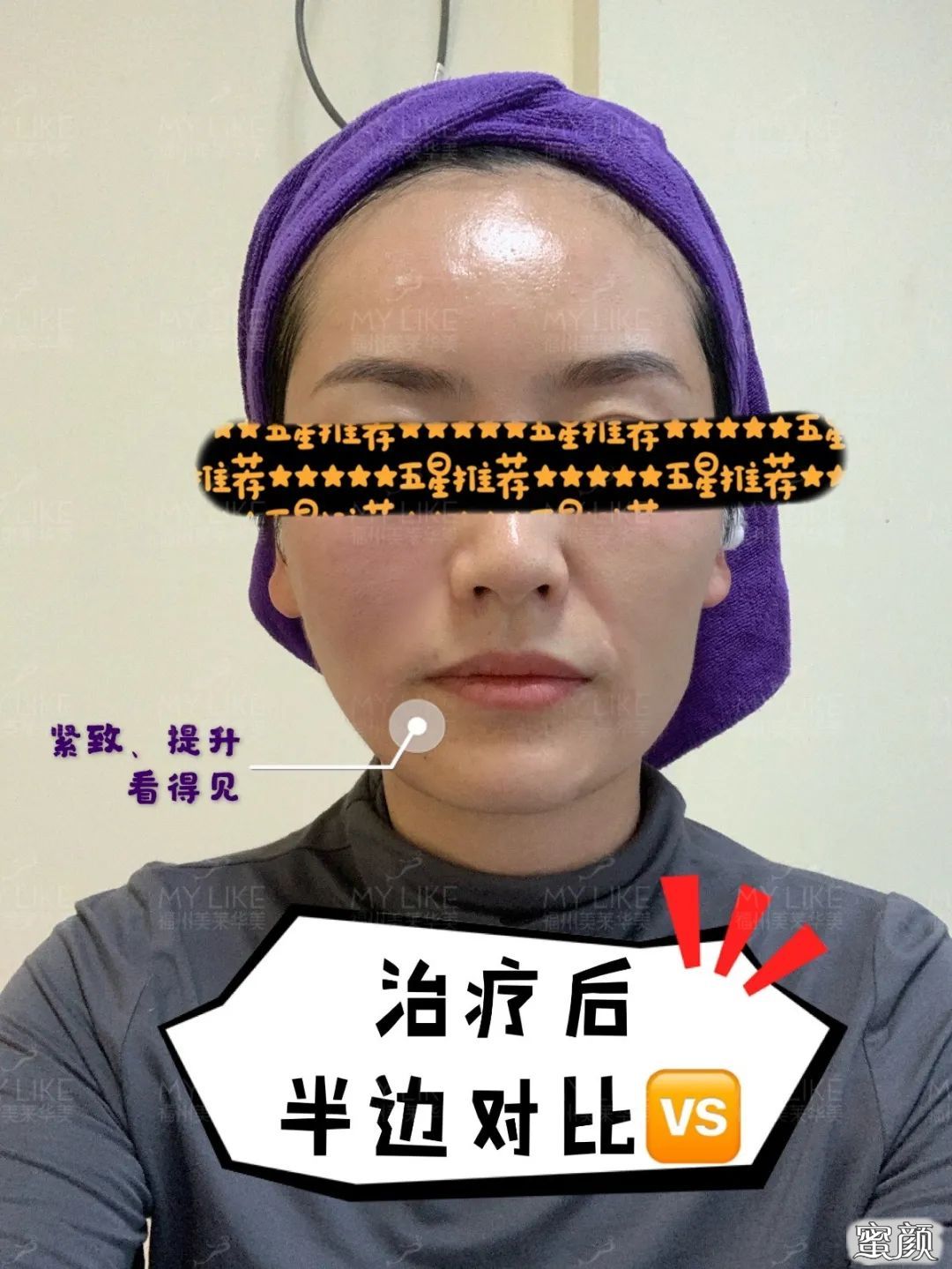 案例图片