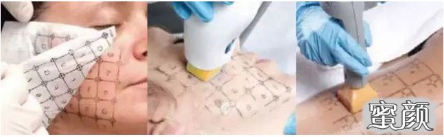 https://img.yiyiaimei.com/mnt/timg/200811/1153511943-5.jpg