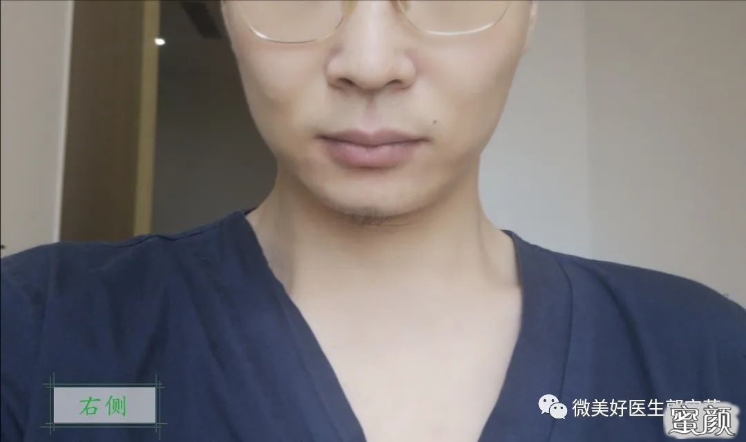 案例图片