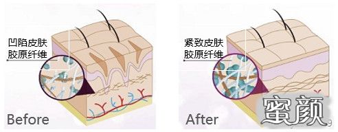 案例图片