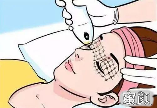 案例图片