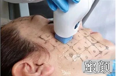 案例图片