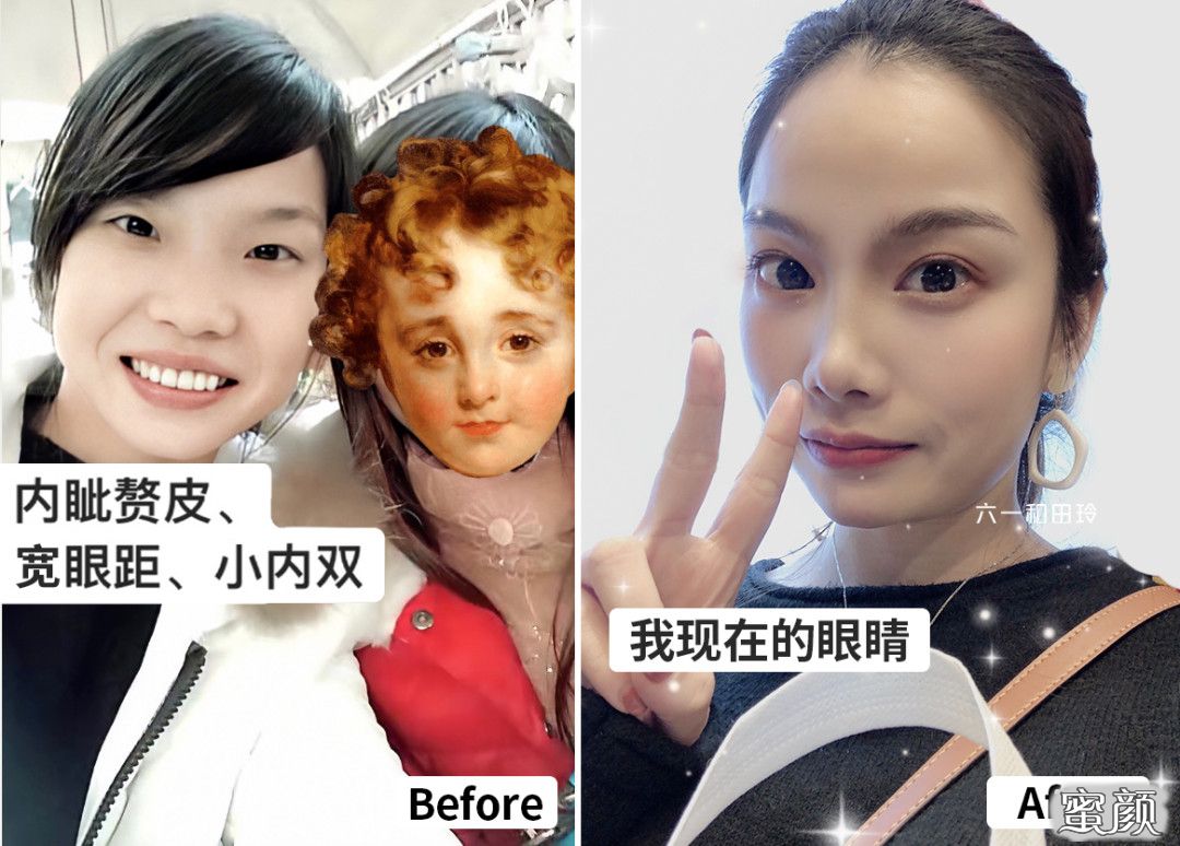 案例图片