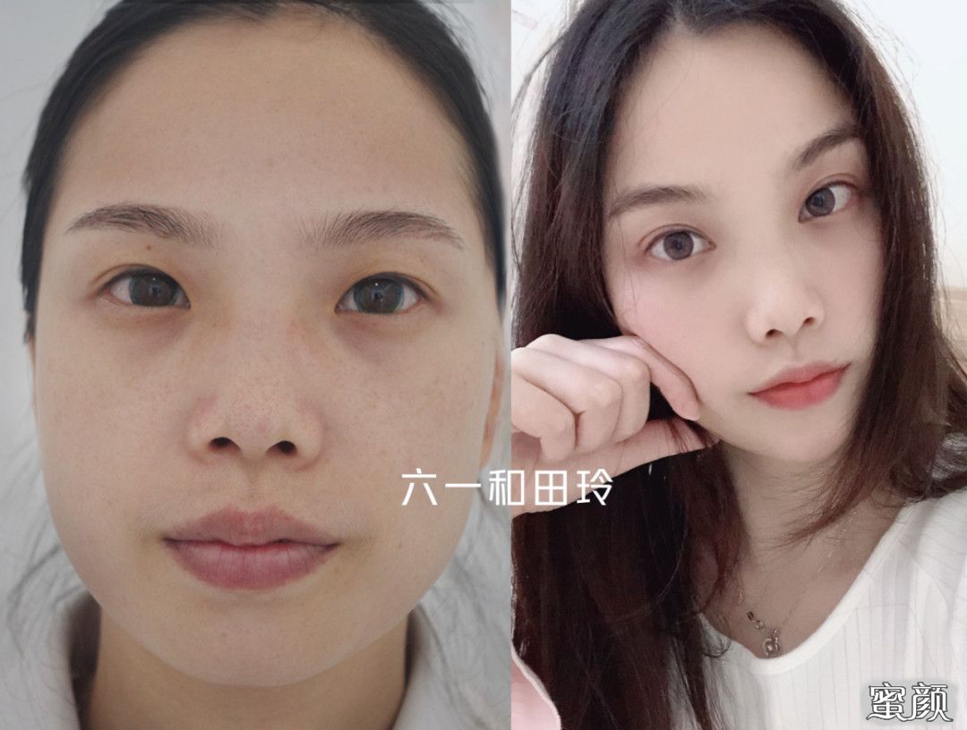 案例图片