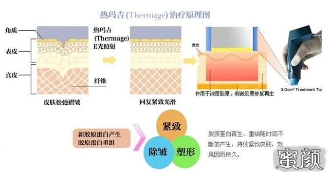 https://img.yiyiaimei.com/mnt/timg/200812/103FMY8-0.jpg
