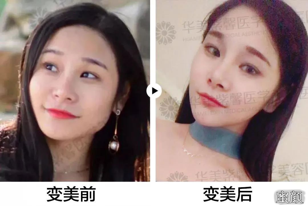 https://img.yiyiaimei.com/mnt/timg/200812/10525HR3-1.jpg 案例图片