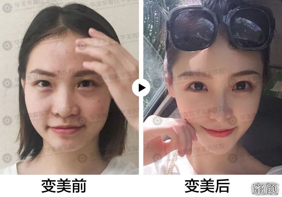 https://img.yiyiaimei.com/mnt/timg/200812/10525UJ5-2.jpg 案例图片