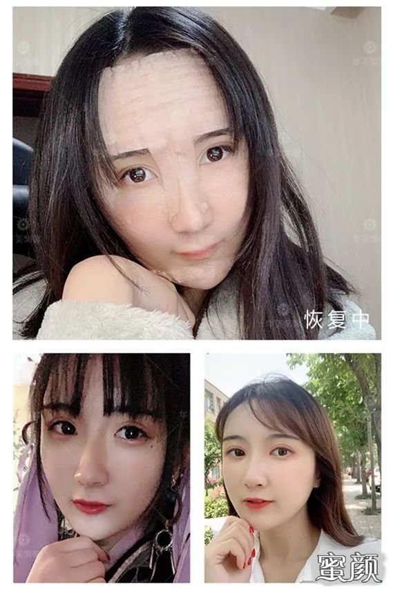 https://img.yiyiaimei.com/mnt/timg/200812/105301C05-7.jpg 案例图片