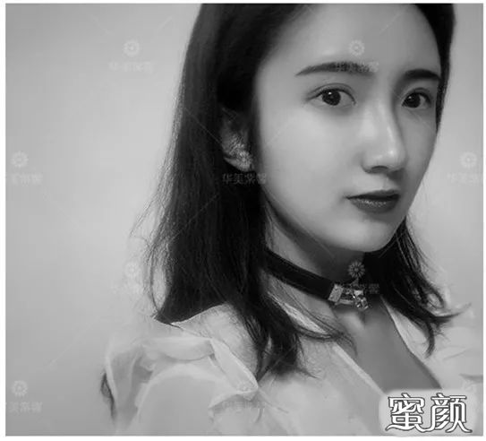 https://img.yiyiaimei.com/mnt/timg/200812/105301M48-8.jpg 案例图片