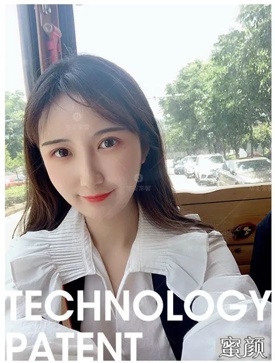 https://img.yiyiaimei.com/mnt/timg/200812/105302E19-9.jpg 案例图片