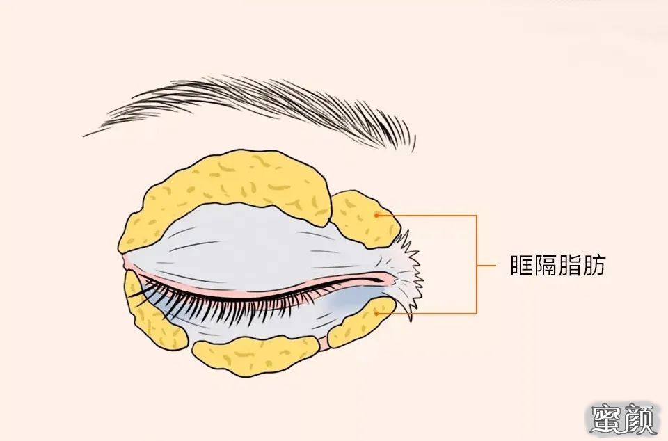 案例图片