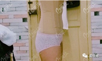 https://img.yiyiaimei.com/mnt/timg/200812/1219364596-2.jpg