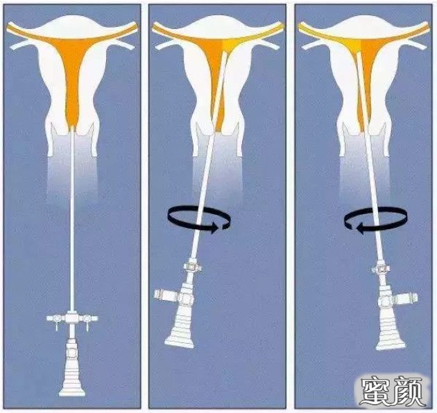 案例图片