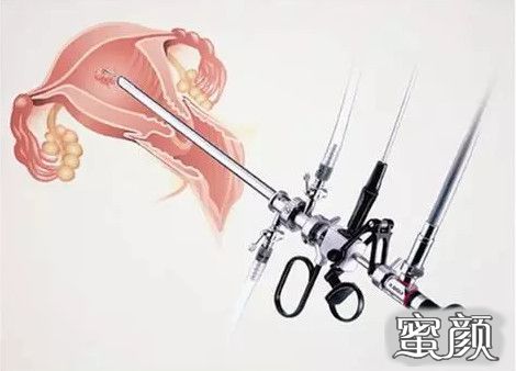 案例图片