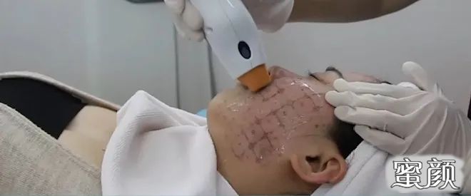 案例图片