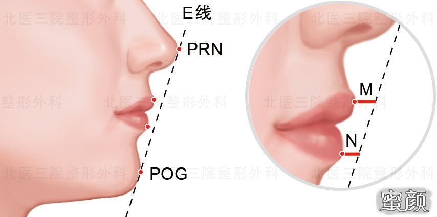 案例图片